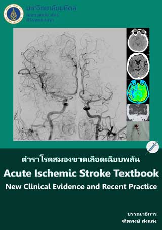 หน้าปก-ตำราโรคสมองขาดเลือดเฉียบพลัน-acute-ischemic-stroke-textbook-ookbee